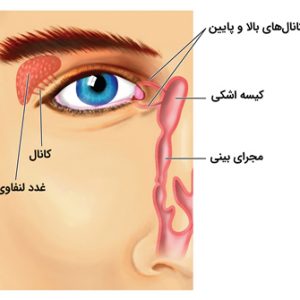 Lacrimal duct surgery or DCR